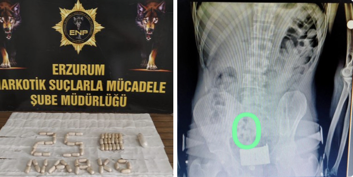 Erzurum’da kuryelerin midelerinden 558 gram uyuşturucu çıktı
